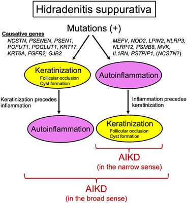 Hidradenitis Suppurativa as a Potential Subtype of Autoinflammatory Keratinization Disease